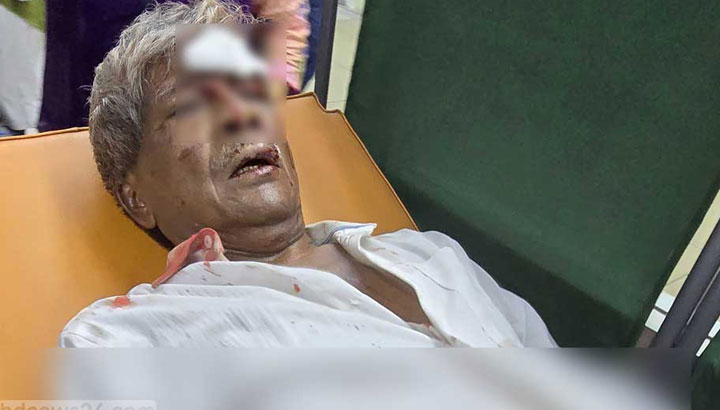 বীর অধ্যাপক আনোয়ার হোসেনের ওপর হামলা